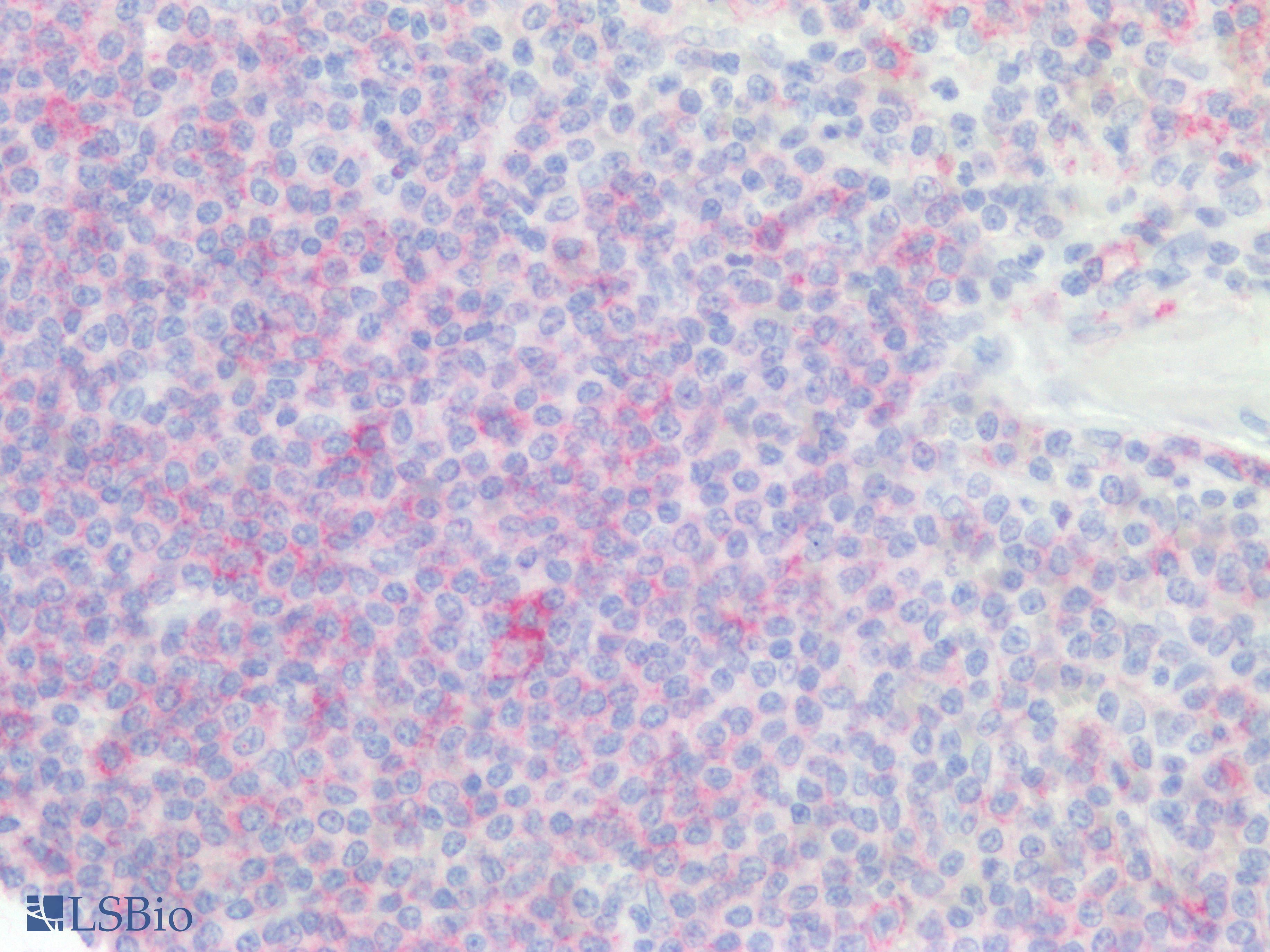 PathPlus™ CD20 Polyclonal Antibody Rabbit Anti-Human IHC | LSBio