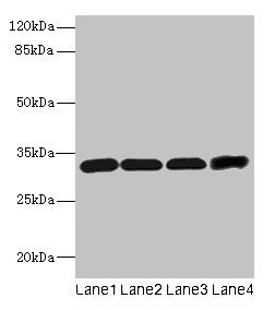CD20 Antibody - Western blot All lanes: KRAS antibody at 4µg/ml Lane 1: Hela whole cell lysate Lane 2: Jurkat whole cell lysate Lane 3: 293T whole cell lysate Lane 4: HL60 whole cell lysate Secondary Goat polyclonal to rabbit IgG at 1/10000 dilution Predicted band size: 33 kDa Observed band size: 33 kDa