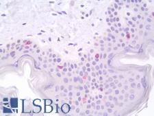 CD207 / Langerin Antibody - Human Skin: Formalin-Fixed, Paraffin-Embedded (FFPE)