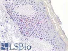 CD207 / Langerin Antibody - Human Skin Langerhans Cells: Formalin-Fixed, Paraffin-Embedded (FFPE)