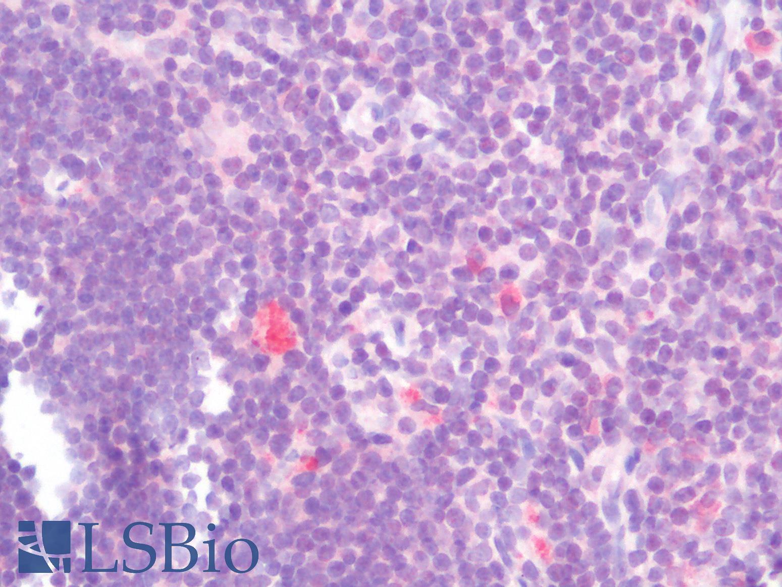 CD274 / B7-H1 / PD-L1 Antibody - Human Thymus: Formalin-Fixed, Paraffin-Embedded (FFPE)