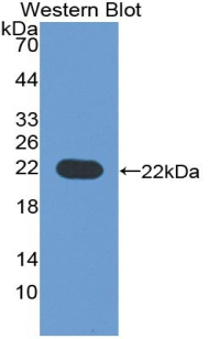 CD276 / B7-H3 Antibody - Western blot of recombinant CD276 / B7-H3.