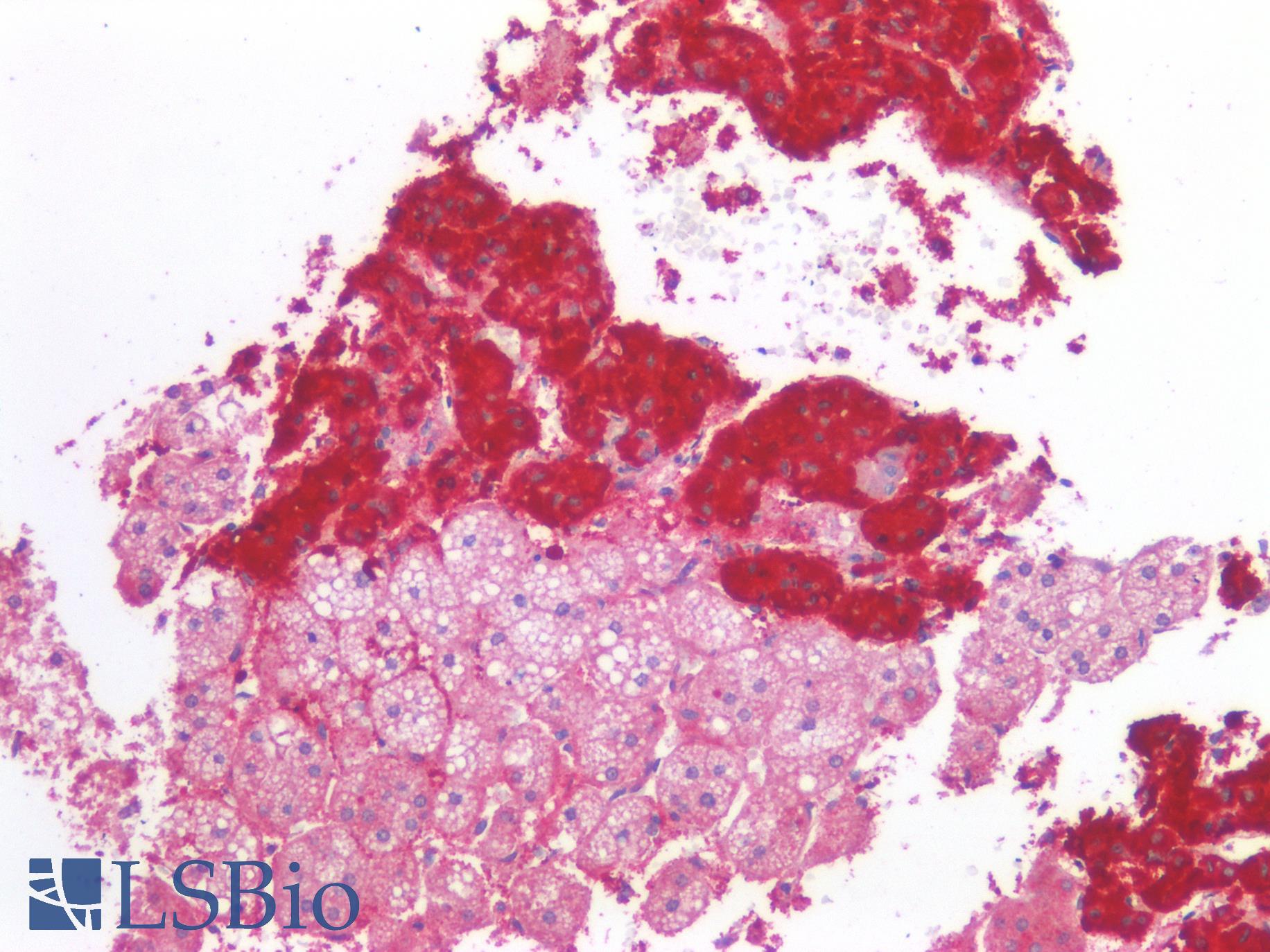 CD276 / B7-H3 Antibody - Human Adrenal: Formalin-Fixed, Paraffin-Embedded (FFPE)