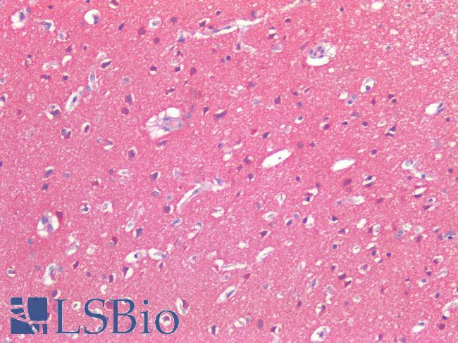 CD276 / B7-H3 Antibody - Human Brain, Cortex: Formalin-Fixed, Paraffin-Embedded (FFPE)