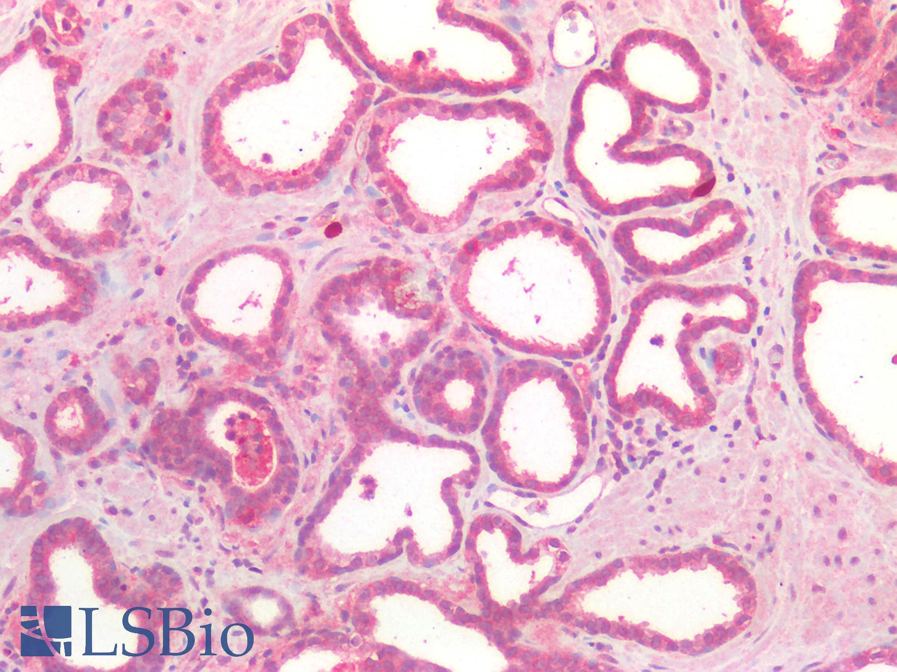 CD276 / B7-H3 Antibody - Human Prostate: Formalin-Fixed, Paraffin-Embedded (FFPE)