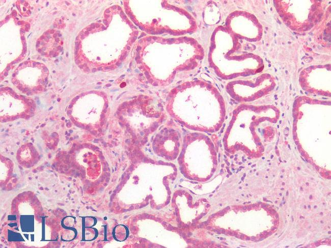 CD276 / B7-H3 Antibody - Human Prostate: Formalin-Fixed, Paraffin-Embedded (FFPE)