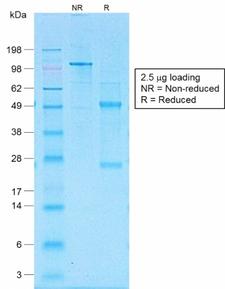 CD30 Antibody - SDS-PAGE Analysis of Purified CD30 Rabbit Recombinant Monoclonal Antibody (Ki-1/1505R). Confirmation of Purity and Integrity of Antibody.