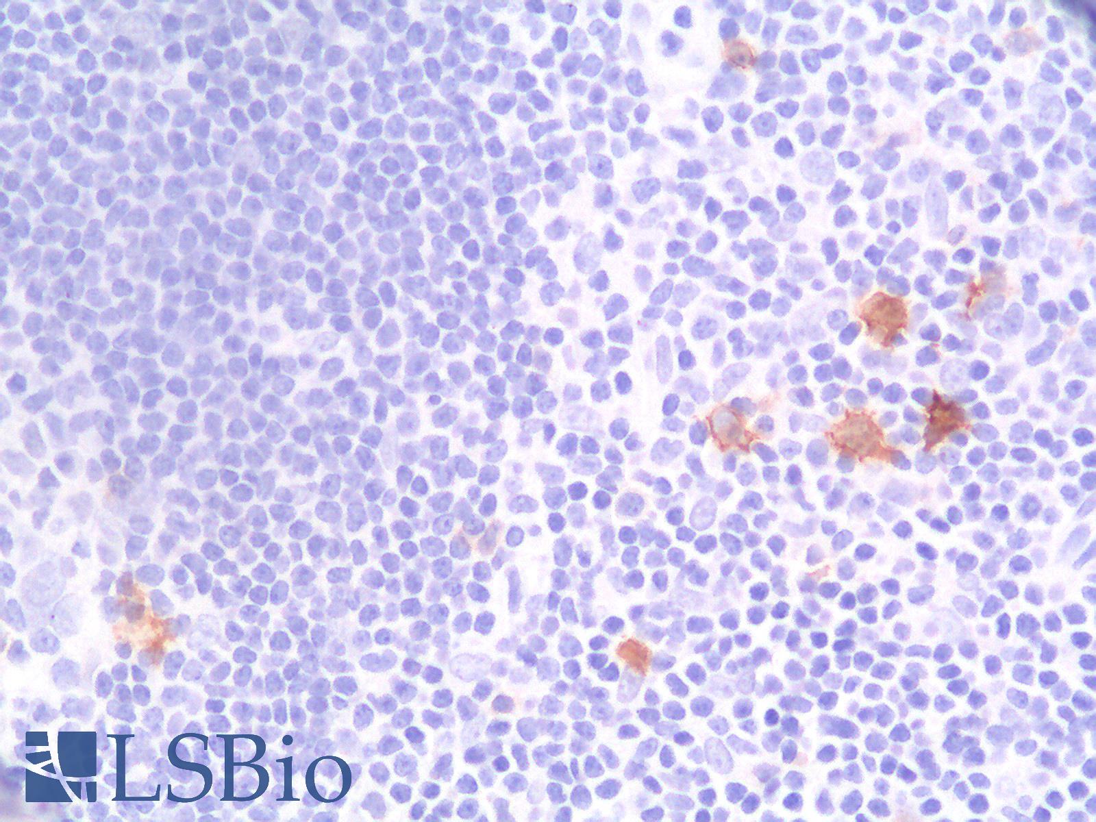 CD30 Antibody - Human Tonsil: Formalin-Fixed, Paraffin-Embedded (FFPE)