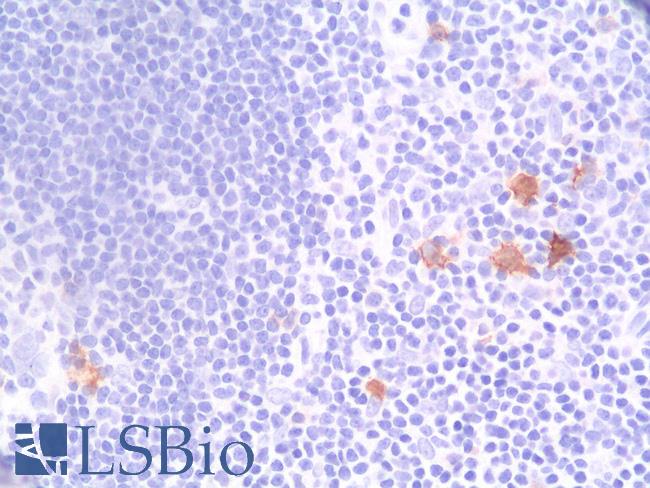 CD30 Antibody - Human Tonsil: Formalin-Fixed, Paraffin-Embedded (FFPE)