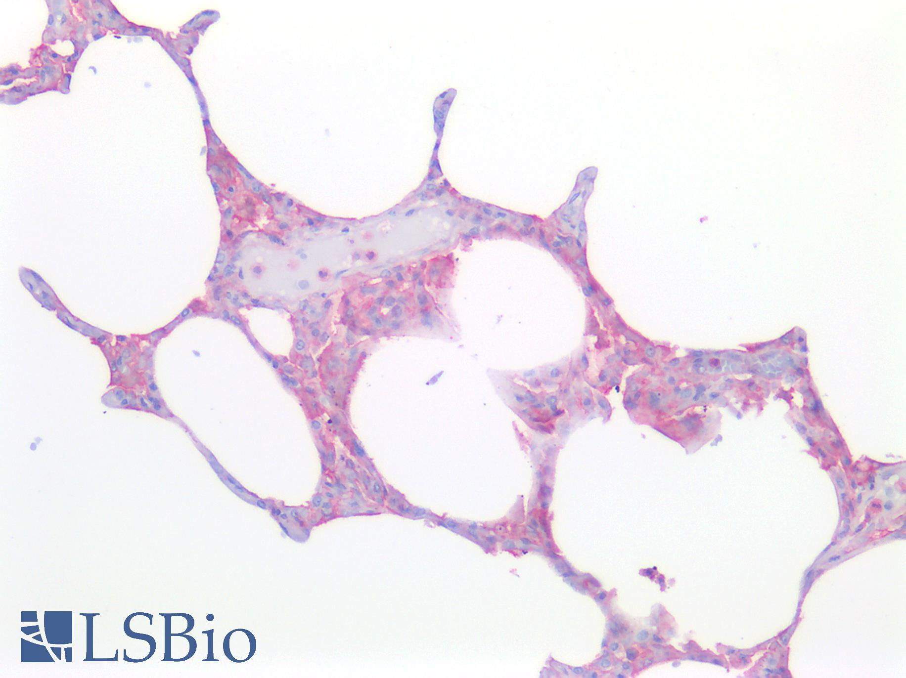 CD33 Antibody - Human Lung: Formalin-Fixed, Paraffin-Embedded (FFPE)