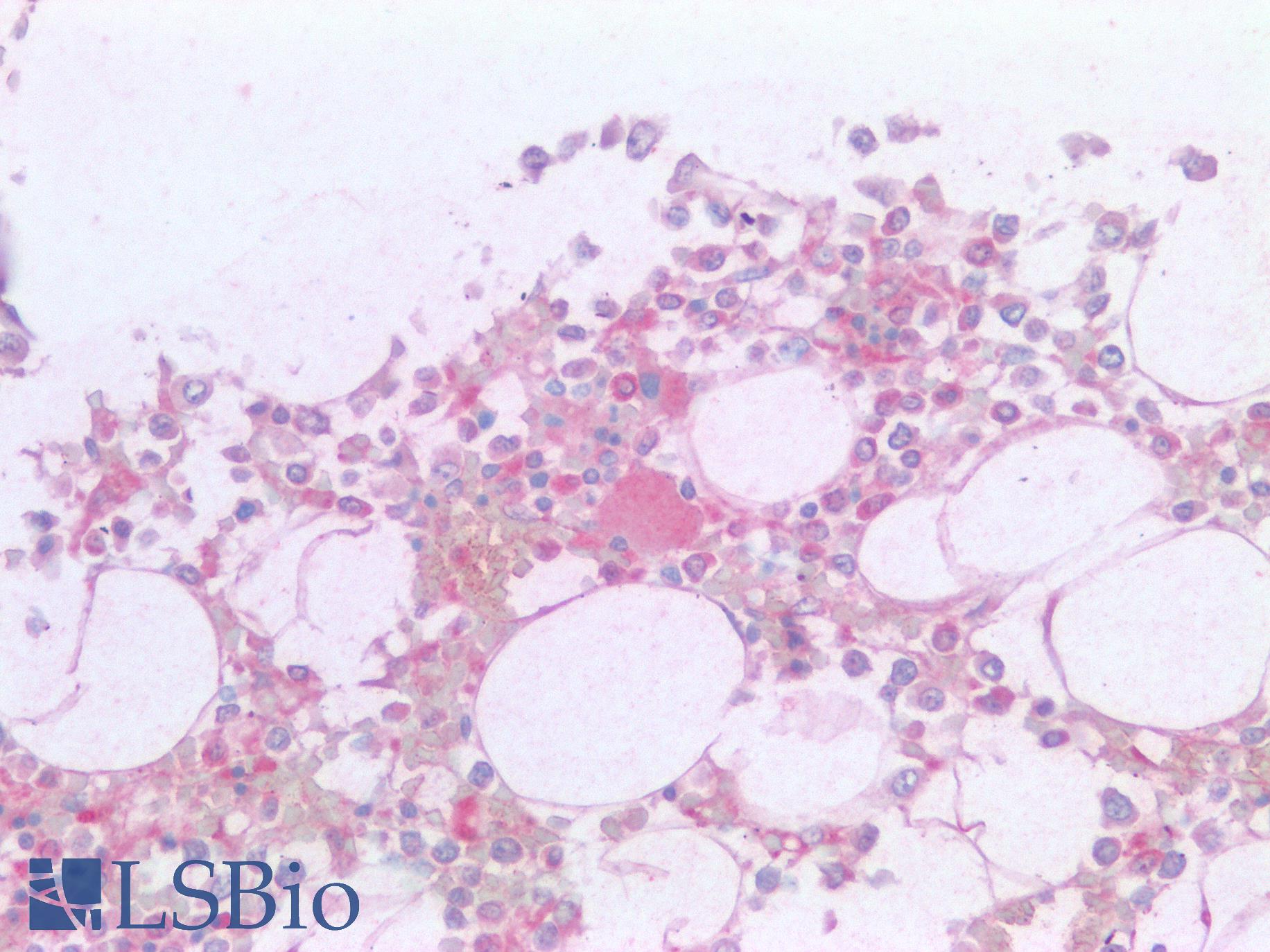 CD36 Antibody - Human Bone, Megakaryocyte: Formalin-Fixed, Paraffin-Embedded (FFPE)