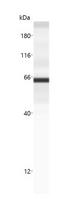 CD36 Antibody - Anti-CD36 antibody (LS-A10534, 20 µg/mL) yields a specific band on capillary Western analysis (Protein Simple, WES, 12-230 kDa separation module) in 0.25 mg/mL human CD36 overexpression lysate.