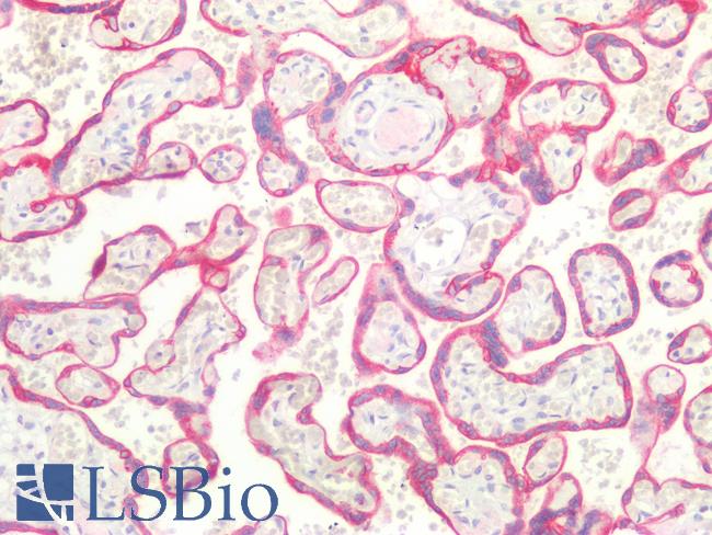 CD36 Antibody - Human Placenta: Formalin-Fixed, Paraffin-Embedded (FFPE)
