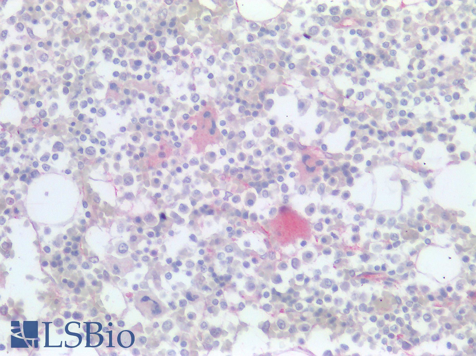 CD36 Antibody - Human Bone Marrow, Megakaryocytes: Formalin-Fixed, Paraffin-Embedded (FFPE)