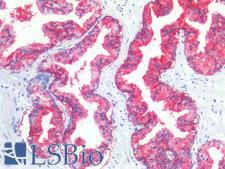 CD38 Antibody - Human Prostate: Formalin-Fixed, Paraffin-Embedded (FFPE)