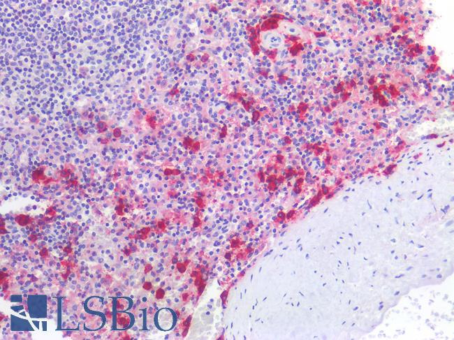 CD38 Antibody - Human Spleen: Formalin-Fixed, Paraffin-Embedded (FFPE)