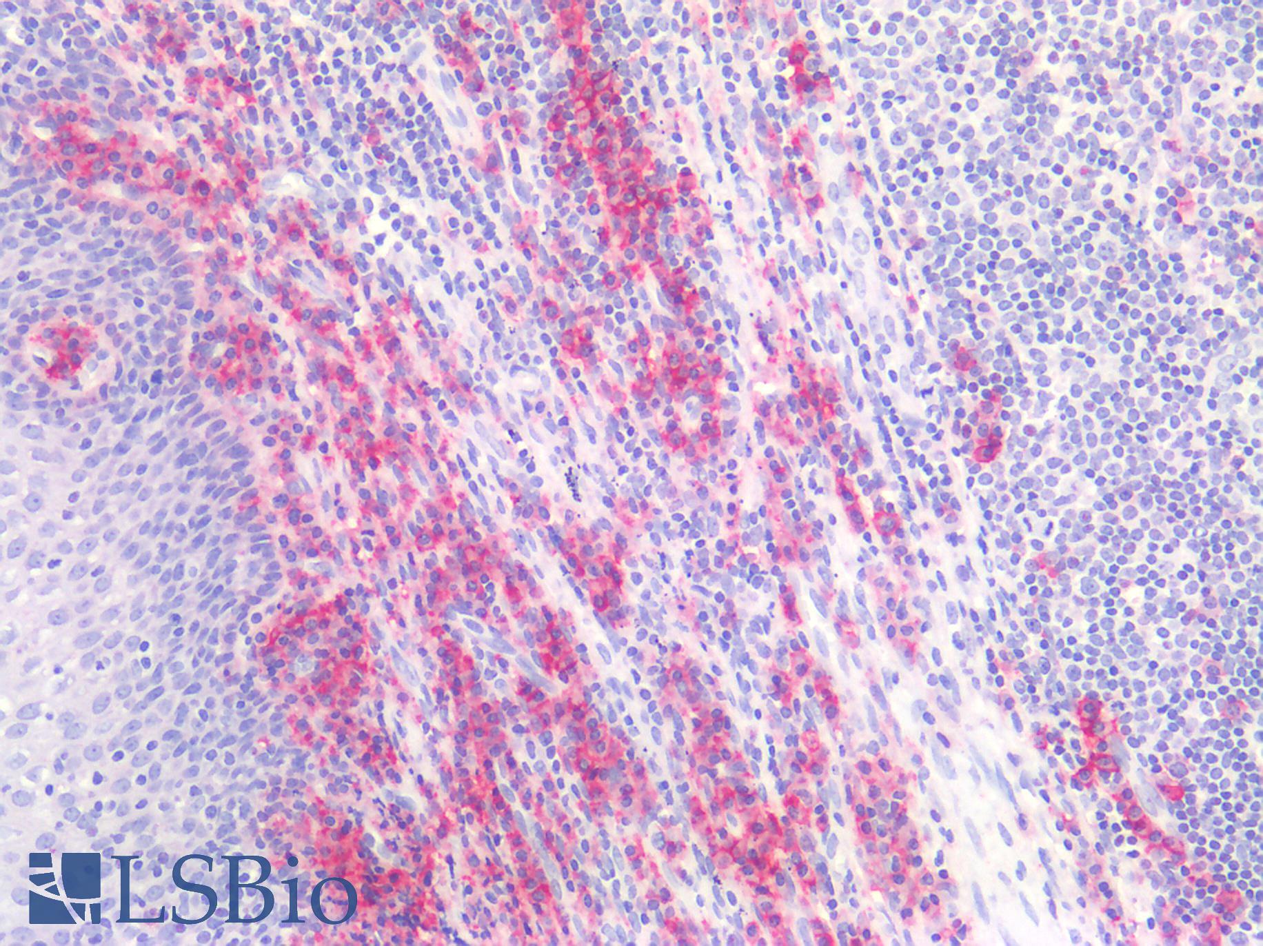 CD38 Antibody - Human Tonsil: Formalin-Fixed, Paraffin-Embedded (FFPE)