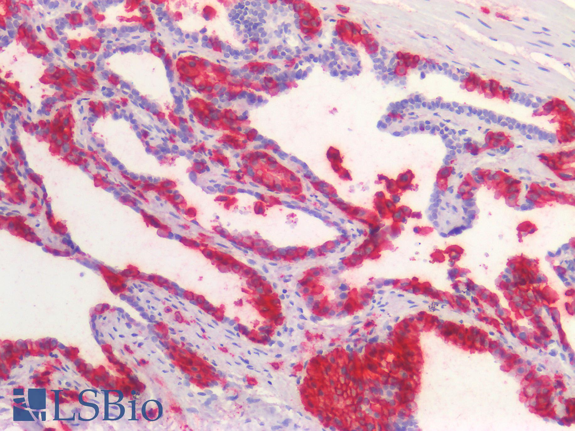 CD38 Antibody - Human Prostate: Formalin-Fixed, Paraffin-Embedded (FFPE)
