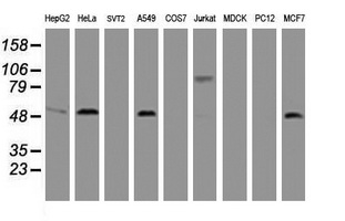 CD4 Antibody - Western blot of extracts (35 ug) from 9 different cell lines by using anti-CD4 monoclonal antibody (HepG2: human; HeLa: human; SVT2: mouse; A549: human; COS7: monkey; Jurkat: human; MDCK: canine; PC12: rat; MCF7: human).