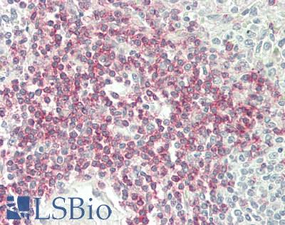 CD4 Antibody - Human Spleen, lymphocytes: Formalin-Fixed, Paraffin-Embedded (FFPE)