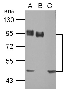 CD44 Antibody - Sample (30 ug of whole cell lysate). A: A549, B: H1299, C: MCF-7. 10% SDS PAGE. CD44 antibody diluted at 1:10000.