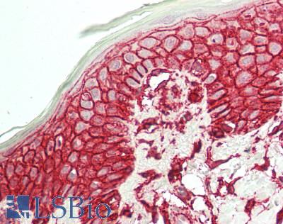 CD44 Antibody - Human Skin, epidermis: Formalin-Fixed, Paraffin-Embedded (FFPE)