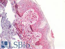 CD44 Antibody - Human Skin: Formalin-Fixed, Paraffin-Embedded (FFPE)