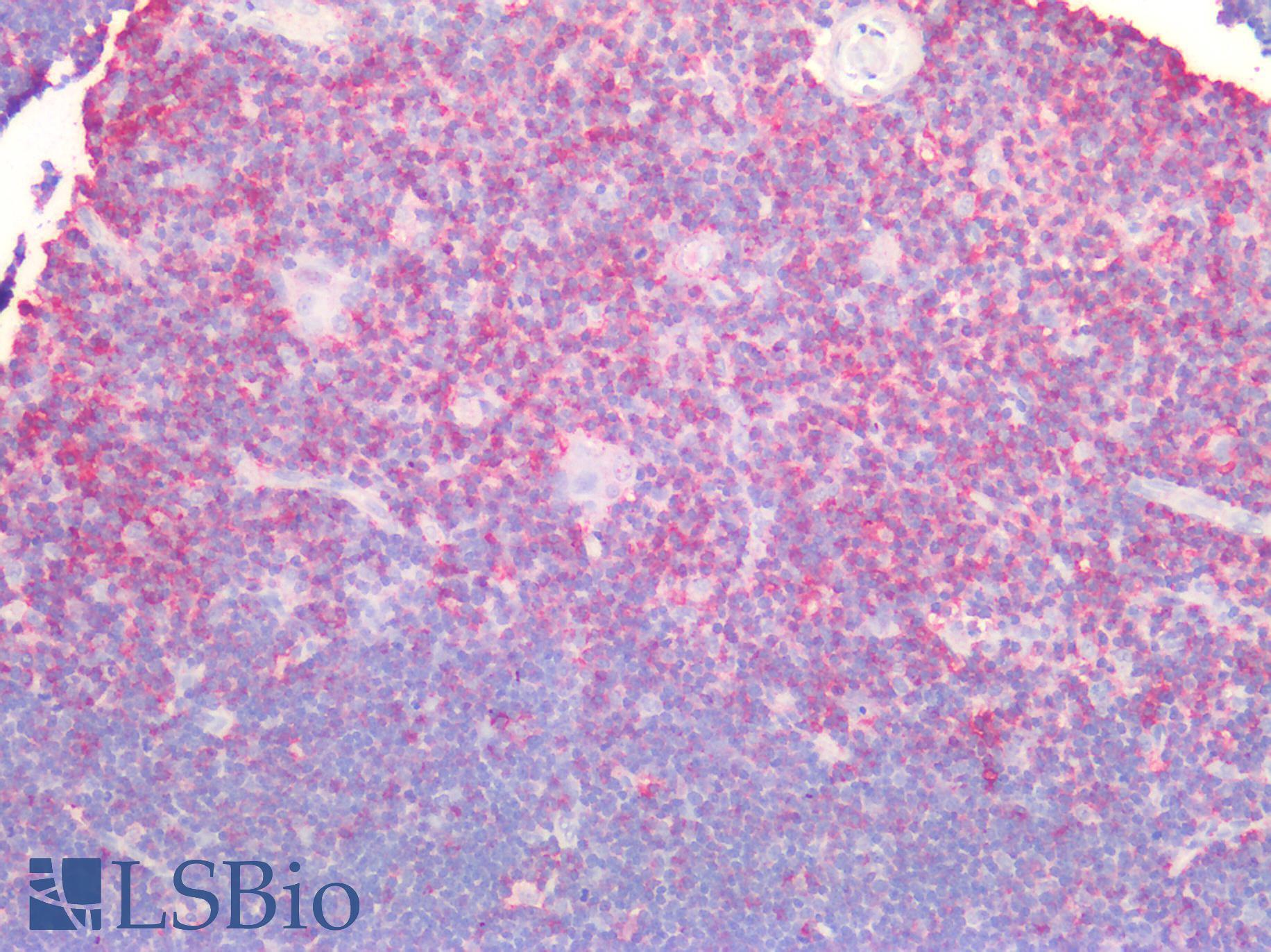 CD44 Antibody - Human Thymus: Formalin-Fixed, Paraffin-Embedded (FFPE)