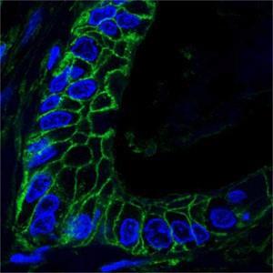 CD44 Antibody - Immunocytochemistry/Immunofluorescence: CD44 Antibody (8E2F3) - Confocal analysis of paraffin-embedded human lung cancer tissues using anti-CD44 mAb (green), showing membrane localization. Blue: DRAQ5 fluorescent DNA dye.