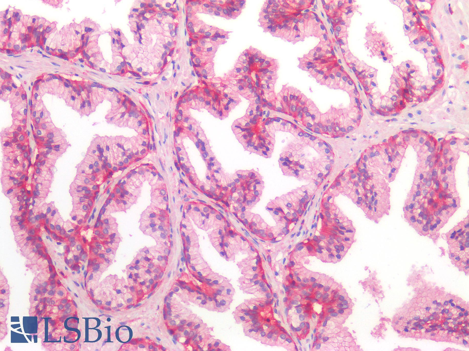 CD44 Antibody - Human Prostate: Formalin-Fixed, Paraffin-Embedded (FFPE)