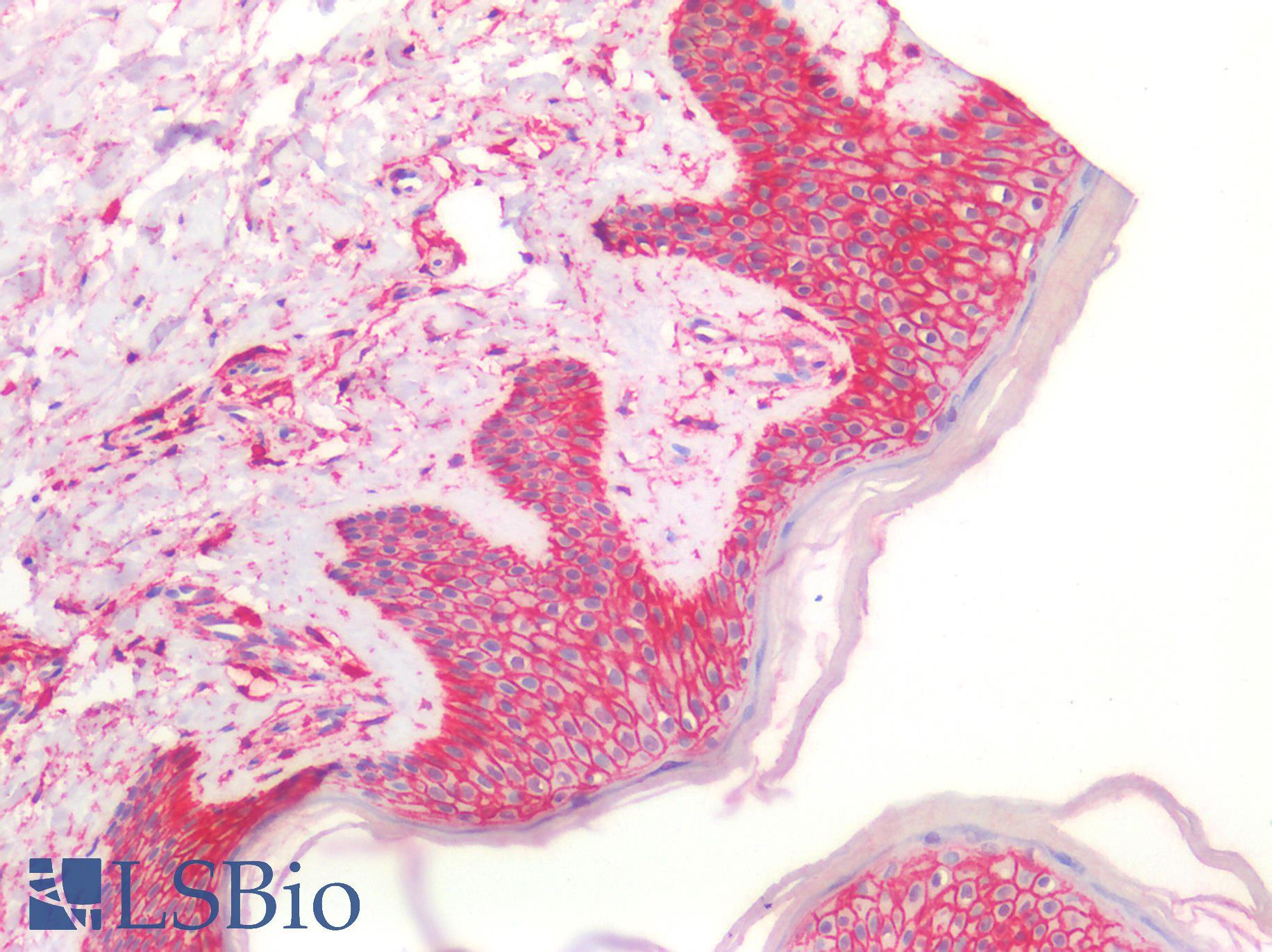 CD44 Antibody - Human Skin: Formalin-Fixed, Paraffin-Embedded (FFPE)