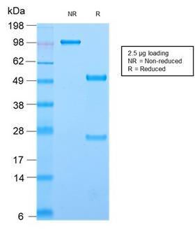CD44 Antibody - SDS-PAGE Analysis Purified CD44 Rabbit Recombinant Monoclonal Antibody (HCAM/2875R). Confirmation of Purity and Integrity of Antibody.