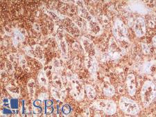 CD44 Antibody - Human Spleen: Formalin-Fixed, Paraffin-Embedded (FFPE)