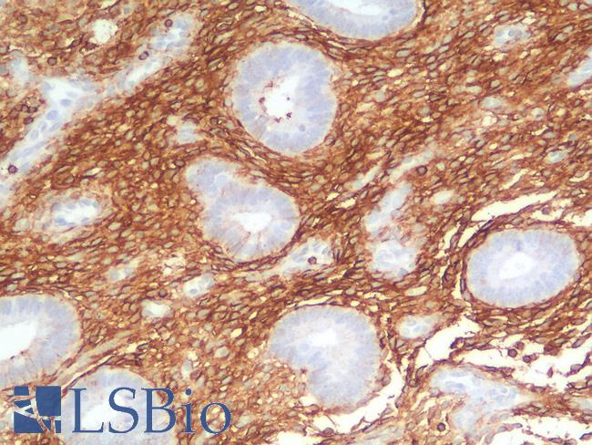 CD44 Antibody - Human Uterus: Formalin-Fixed, Paraffin-Embedded (FFPE)