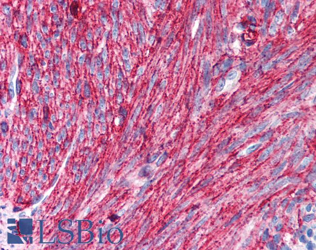 CD44 Antibody - Anti-CD44 antibody IHC of human uterus, smooth muscle. Immunohistochemistry of formalin-fixed, paraffin-embedded tissue after heat-induced antigen retrieval. Antibody concentration 10 ug/ml.
