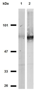 CD44 Antibody - Western blotting analysis of CD44 in MOLT-4 cells (lane 1) and HeLa cells (lane 2) using anti-CD44 (MEM-263) purified; non-reducing conditions. 