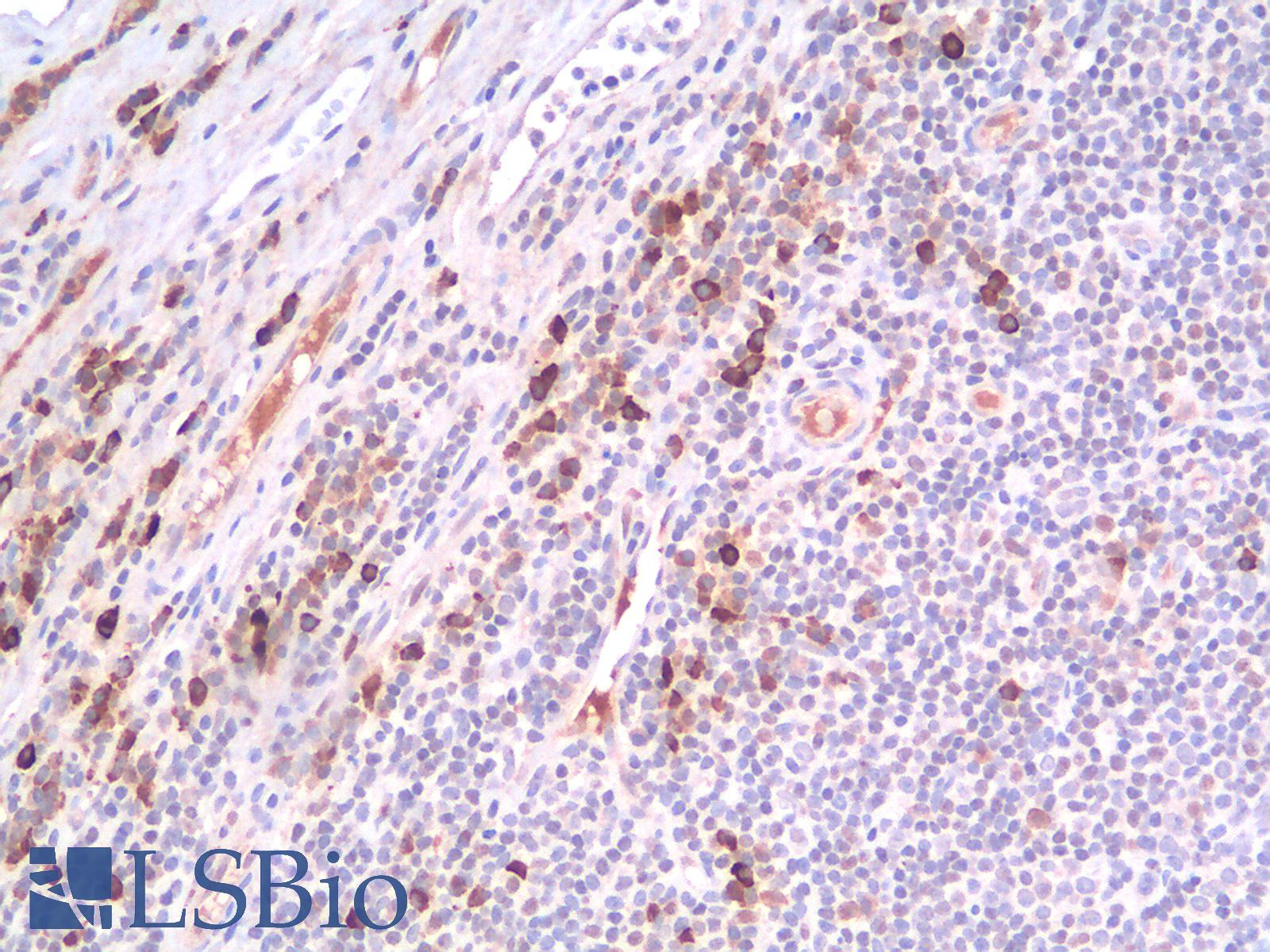 CD44 Antibody - Human Tonsil: Formalin-Fixed, Paraffin-Embedded (FFPE)