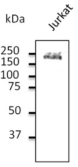 CD45 / LCA Antibody - Western blot. Endogenous CD45 detected with CD45 antibody at 1:500 dilution. Lysate at 100 ug per lane and rabbit polyclonal to goat IgG (HRP) at 1:10000 dilution.