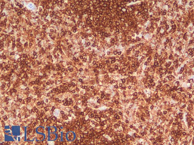 CD45 / LCA Antibody - Human Spleen: Formalin-Fixed, Paraffin-Embedded (FFPE)