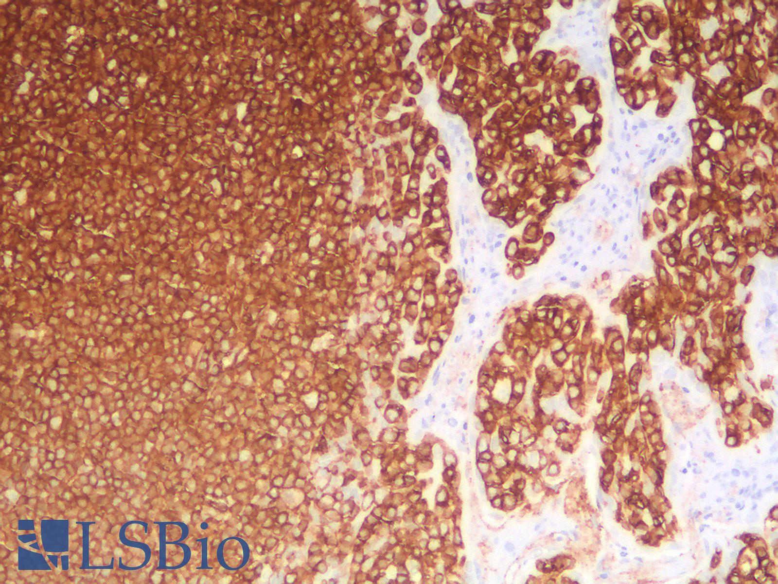 CD45 / LCA Antibody - Human Tonsil: Formalin-Fixed, Paraffin-Embedded (FFPE)