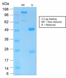 CD45 / LCA Antibody - SDS-PAGE Analysis Purified CD45 Rabbit Recombinant Monoclonal Antibody (PTPRC/1975R). Confirmation of Purity and Integrity of Antibody.