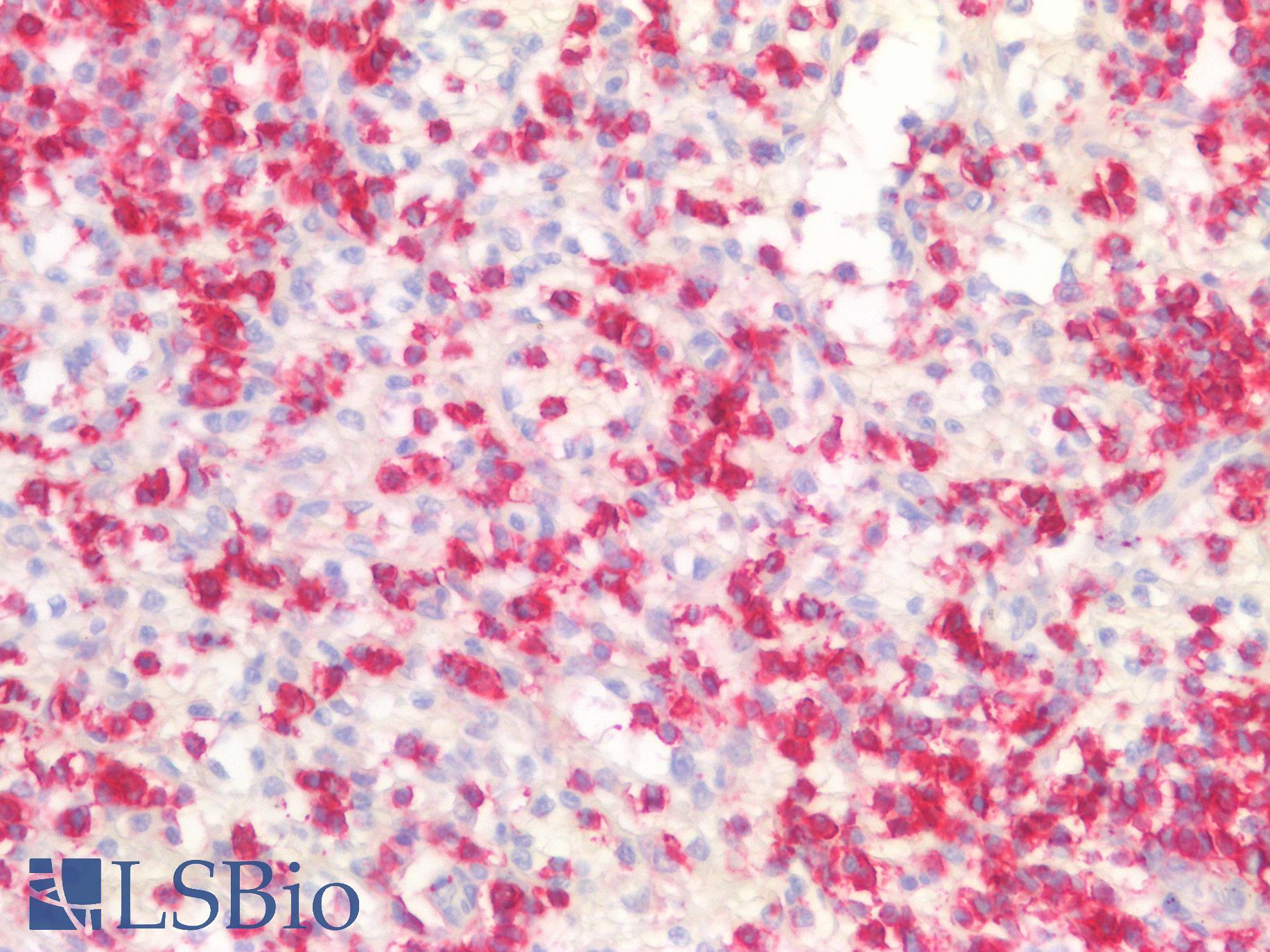 CD45RB Antibody - Human Spleen: Formalin-Fixed, Paraffin-Embedded (FFPE)