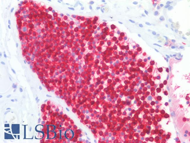 CD45RB Antibody - Human Tonsil, Lymphocytes: Formalin-Fixed, Paraffin-Embedded (FFPE)