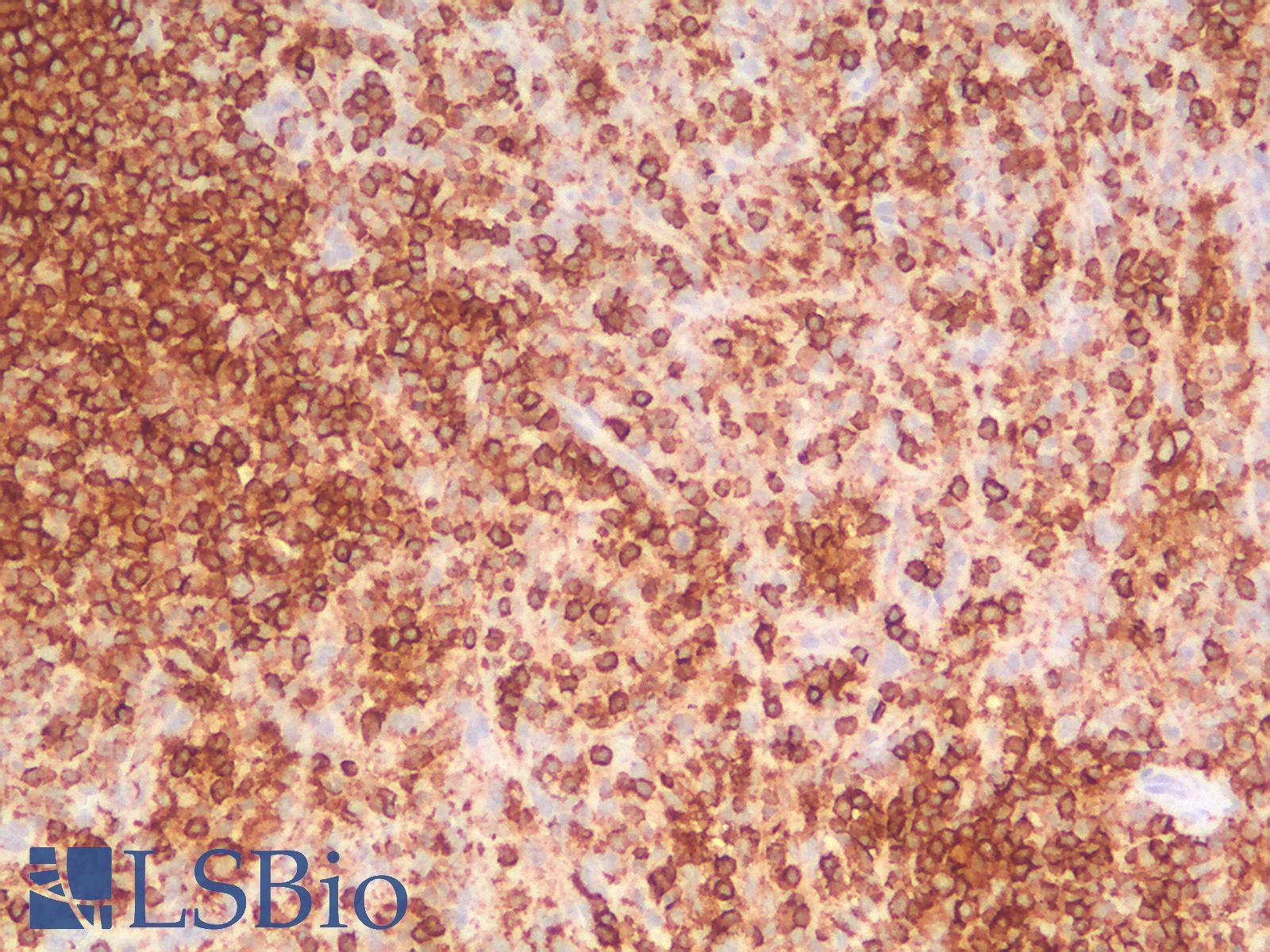 CD45RB Antibody - Human Spleen: Formalin-Fixed, Paraffin-Embedded (FFPE)