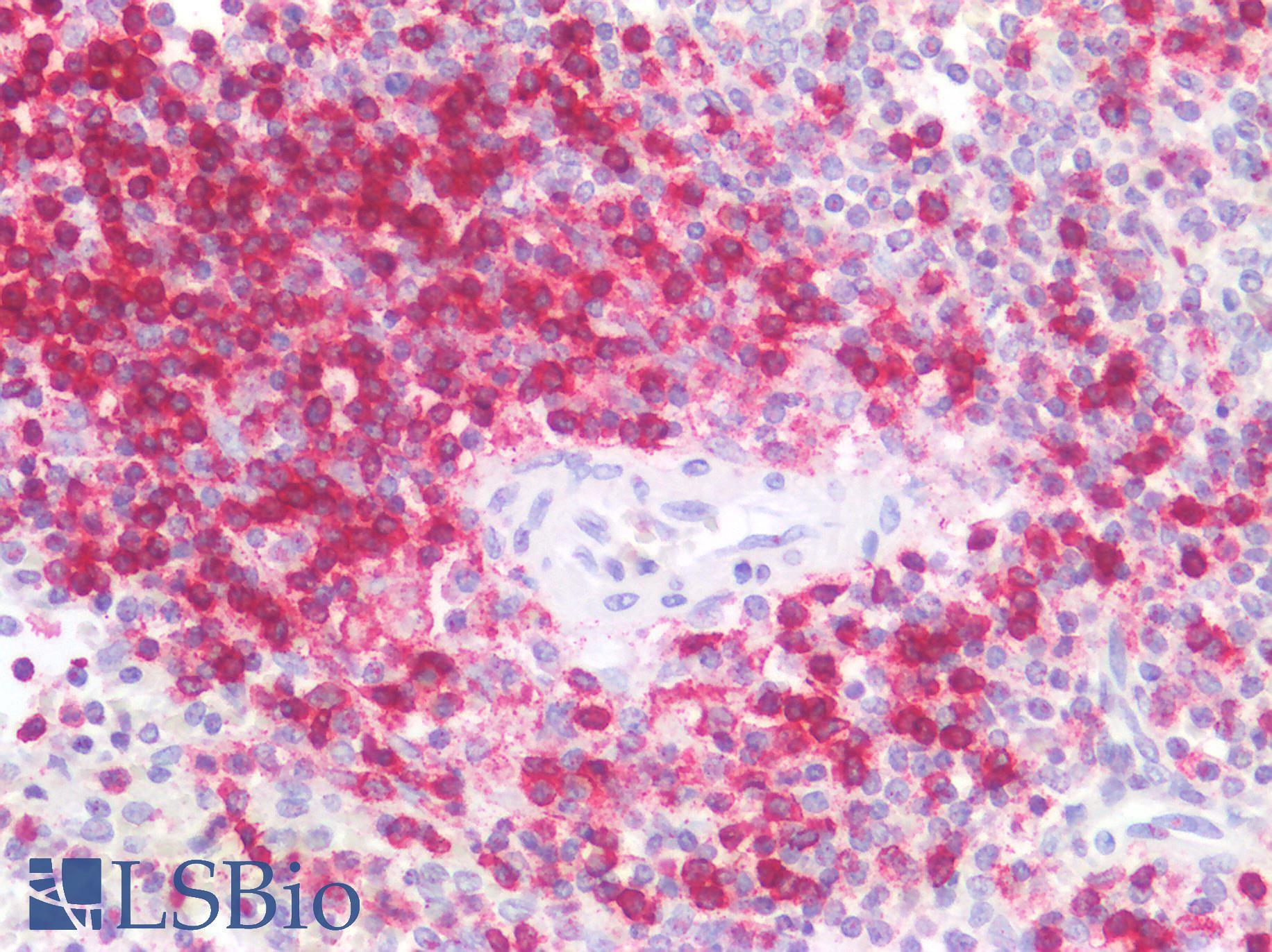 CD45RO Antibody - Human Spleen: Formalin-Fixed, Paraffin-Embedded (FFPE)