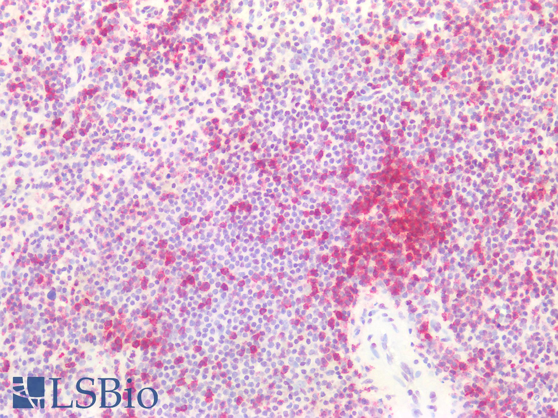 CD45RO Antibody - Human Spleen: Formalin-Fixed, Paraffin-Embedded (FFPE)