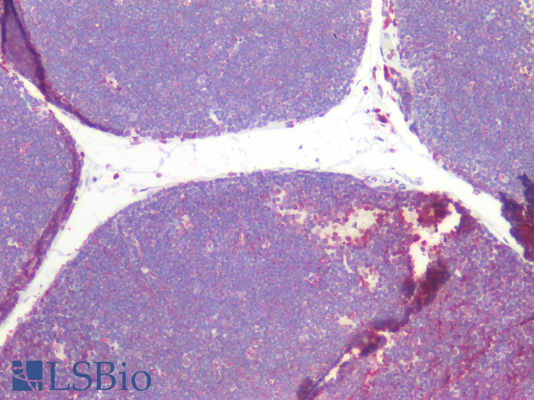 CD45RO Antibody - Human Thymus: Formalin-Fixed, Paraffin-Embedded (FFPE)