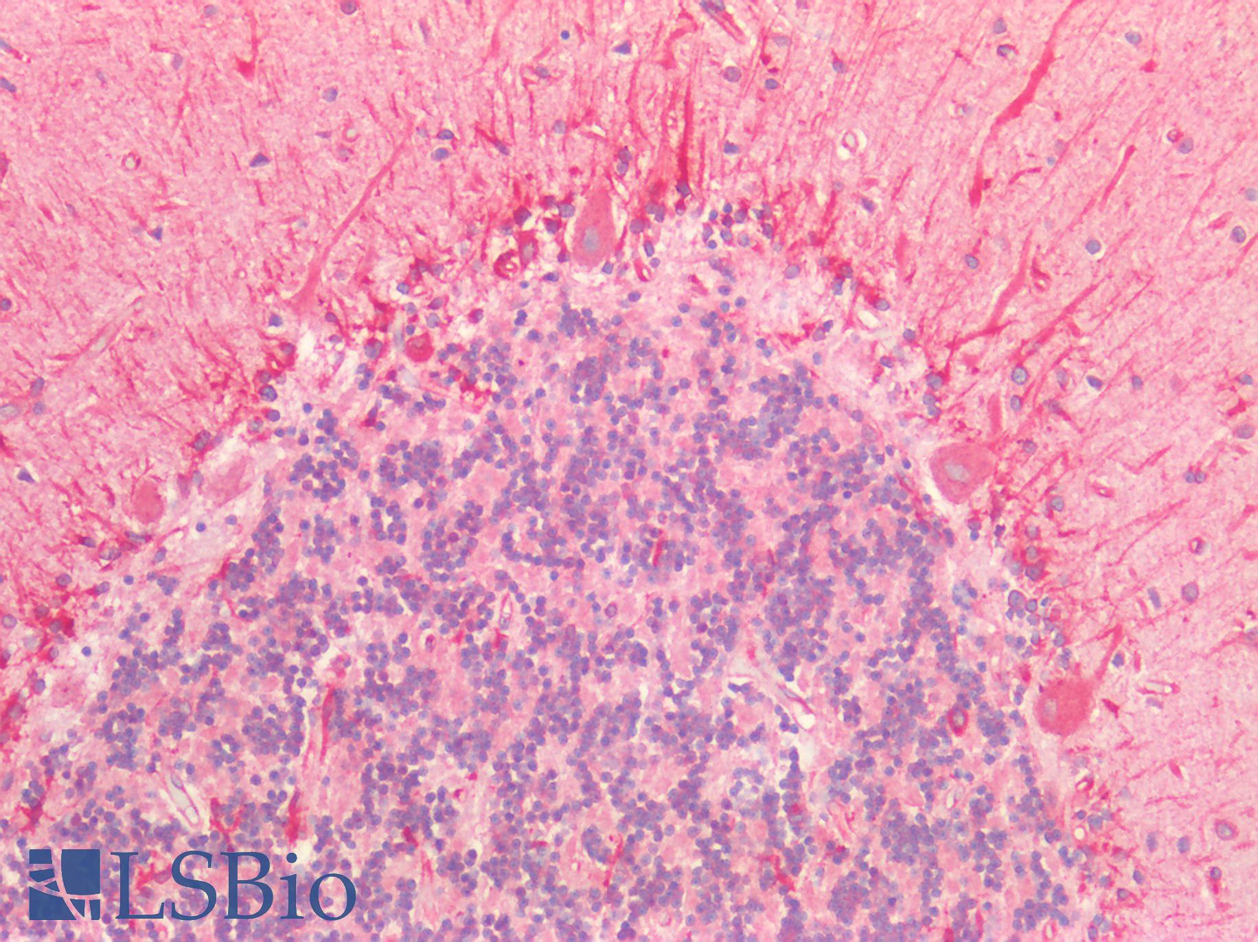CD47 Antibody - Human Brain, Cerebellum: Formalin-Fixed, Paraffin-Embedded (FFPE)