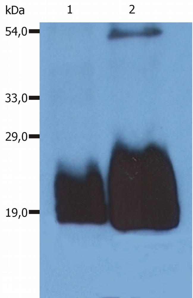 CD59 Antibody - Western Blotting analysis (non-reducing conditions) of whole cell lysate of HPB-ALL human peripheral blood T cell leukemia cell line using anti-CD59 (MEM-43/5).  Lane 1: original cell lysate  Lane 2: material immunoprecipitated with anti-human CD59 (MEM-43)