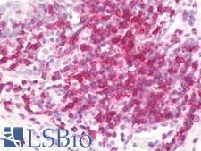CD6 Antibody - Human Tonsil: Formalin-Fixed, Paraffin-Embedded (FFPE)  This image was taken for the unmodified form of this product. Other forms have not been tested.
